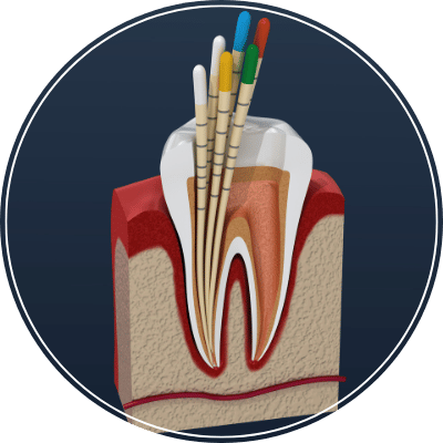 Endodontia - MDC Odontologia SP