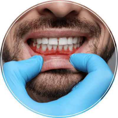 Periodontia_ - Clínica MDC Odontologia