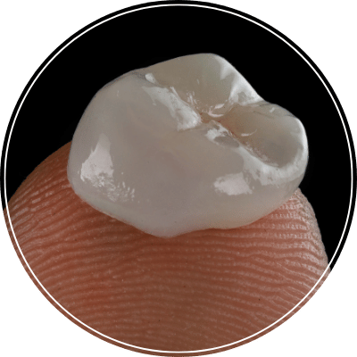 Prótese Dental_ - Clínica MDC Odontologia