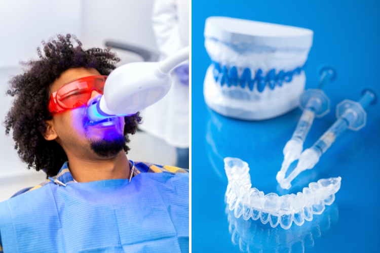 clareamento dental híbrido
