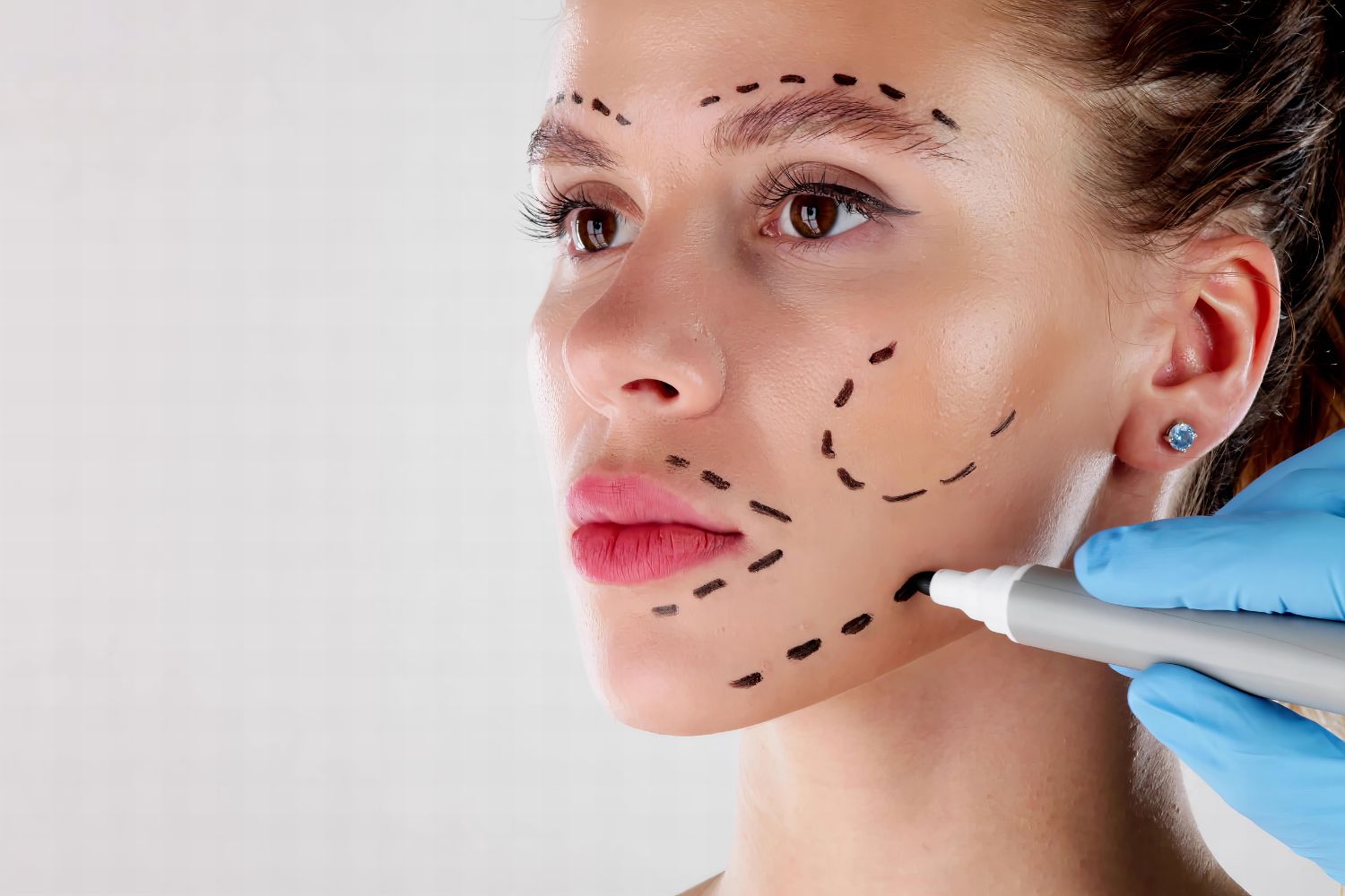 Harmonização Orofacial