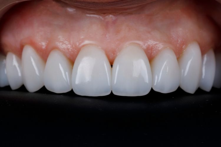 Odontologia Estética