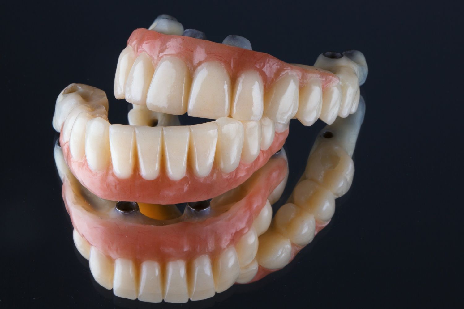 Prótese Dental
