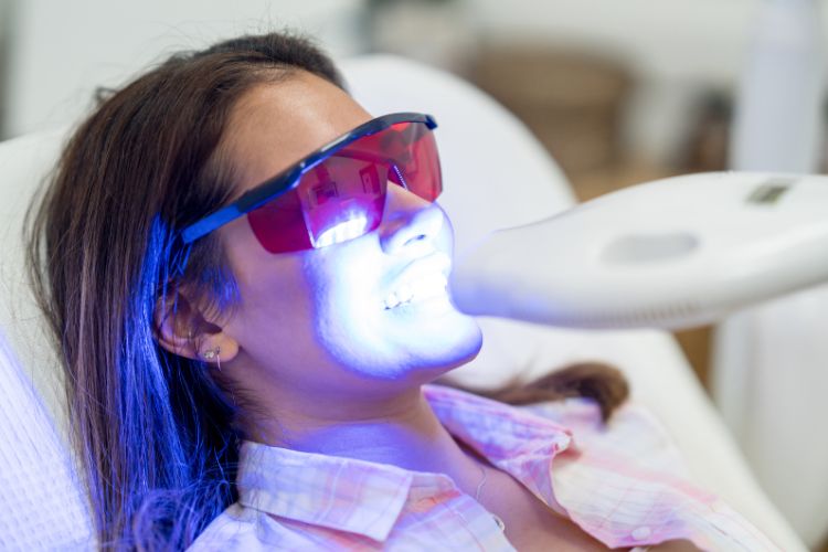 tipos de clareamento dental